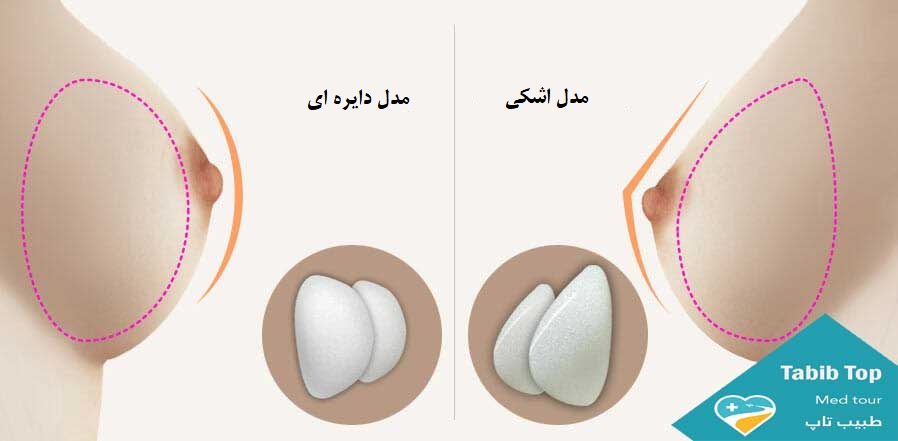 تجمیل الثدی