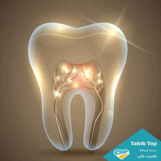 فينير الأسنان جيدة أم سيئة؟