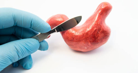 عمل لاغری اسلیو