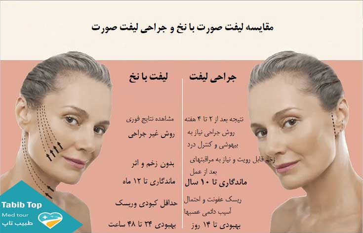 مقایسه لیفت با نخ وجراحی لیفت