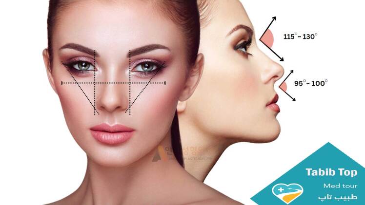 عمل جراحی بینی Rhinoplasty (راینوپلاستی)