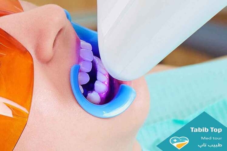 جرم‌گیری و سفید کردن دندان: راز داشتن لبخند زیبا