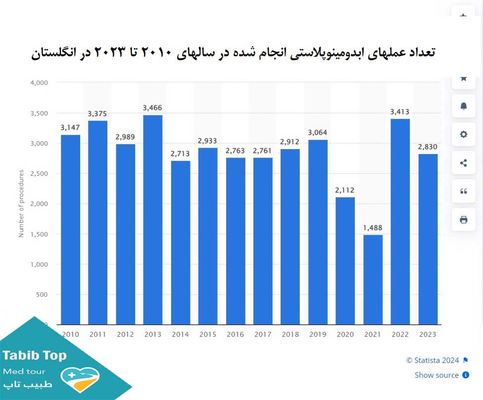  ابدومینوپلاستی در دنیا