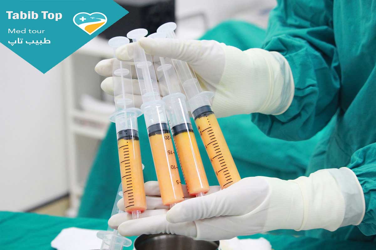 تجمیل الثدی