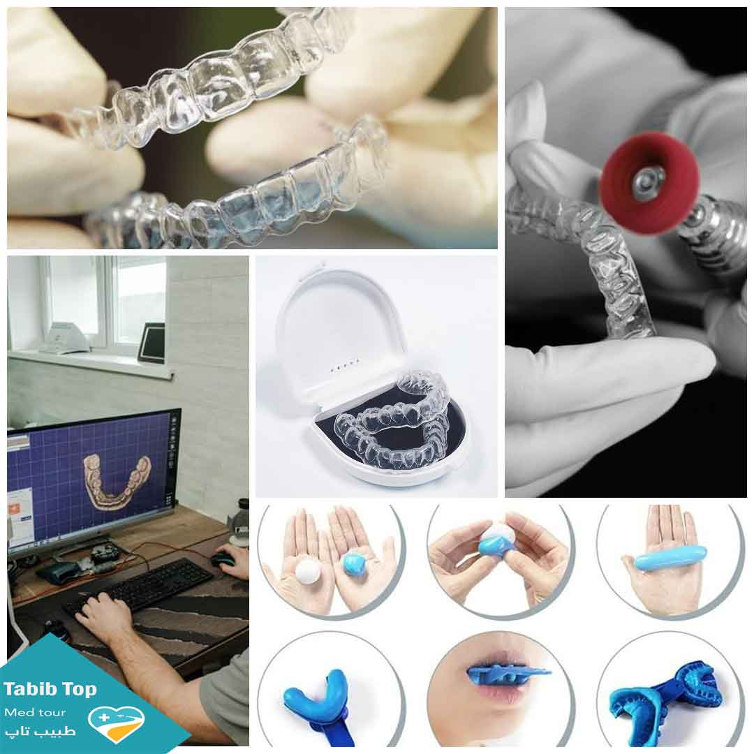 ارتدونسی بزرگسالان