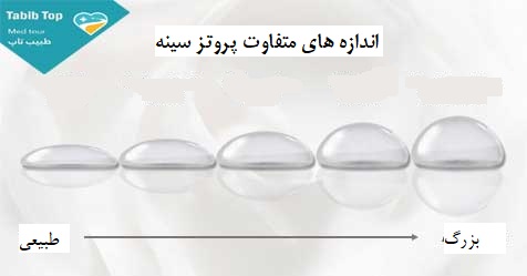 ماموپلاستی